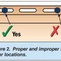 Proper fastener location for vinyl siding. 